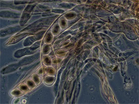 morel asci