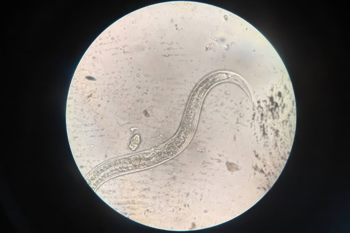 nematode under microscope
